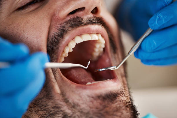 Best Emergency Orthodontic Repairs in Baywood Park, CA